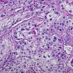 Mopec Histology & IHC Control Slides for TMA and Normal Human Tissue - Image 2